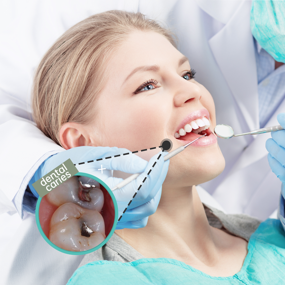 Decayed Tooth
