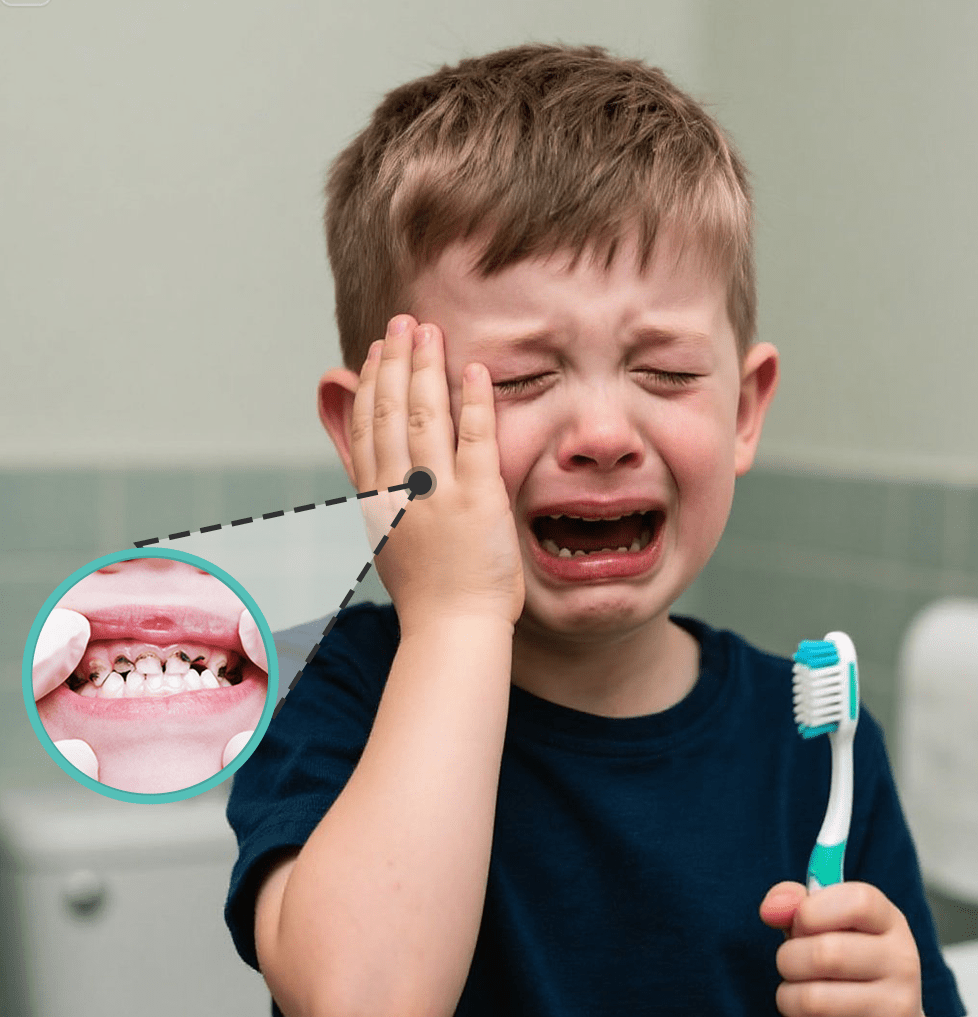 Dental caries