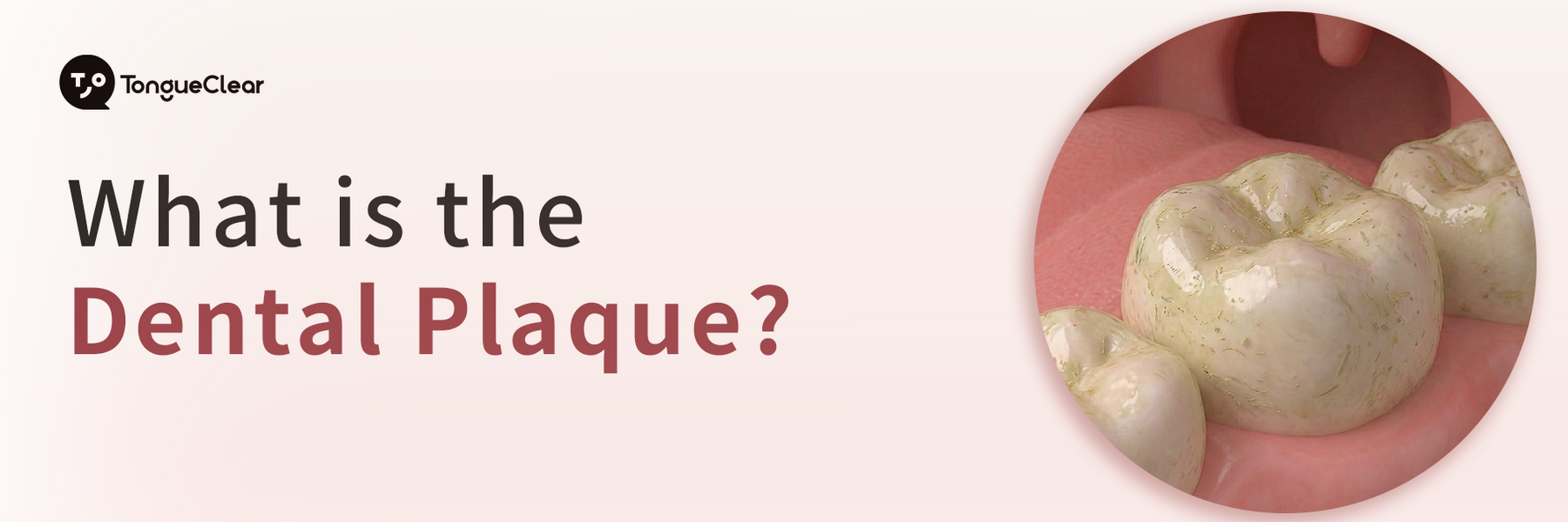 What is the Dental Plaque?