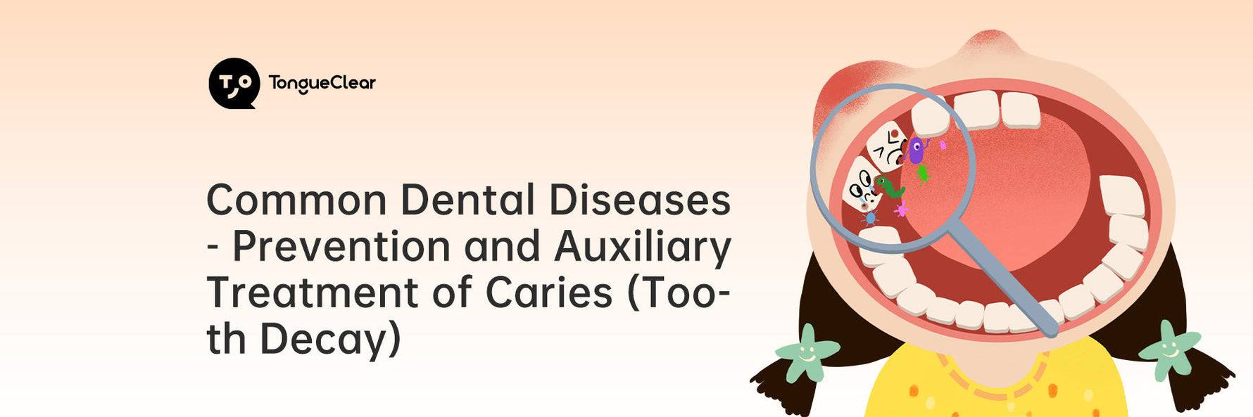 Common Dental Diseases - Prevention and Auxiliary Treatment of Caries (Tooth Decay)