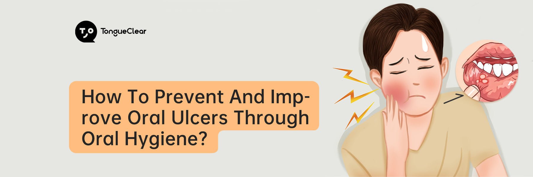 How to prevent and improve oral ulcers through oral hygiene