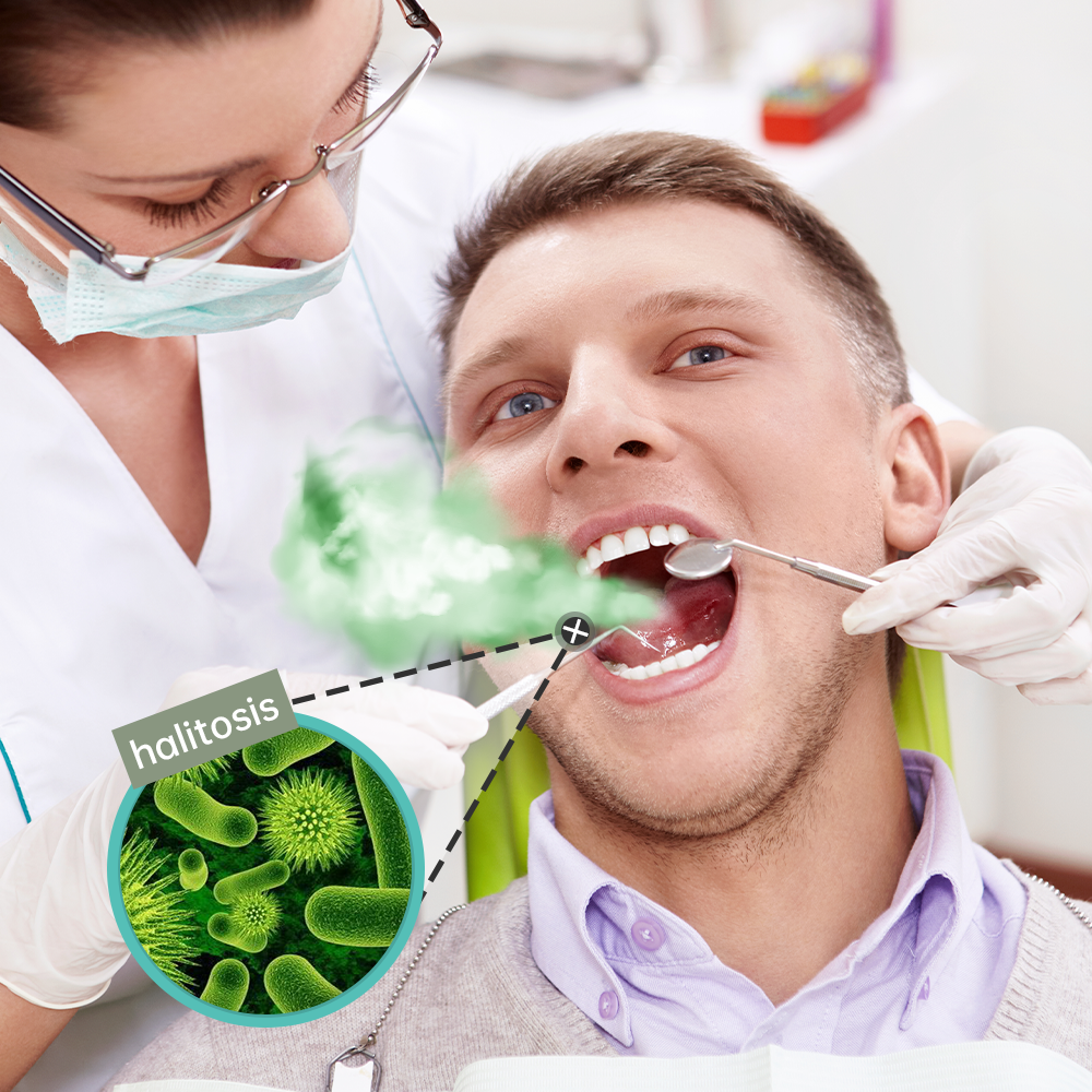 Bad Breath
